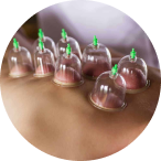 muscle fix cupping therapy service